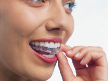 マウスピース矯正1