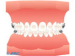 目立たない装置