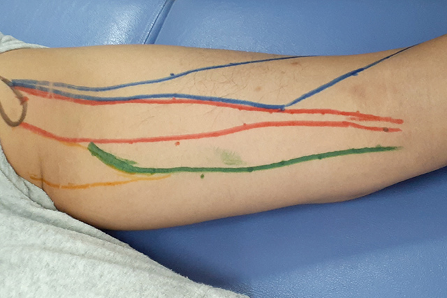 ハムストリングの描画