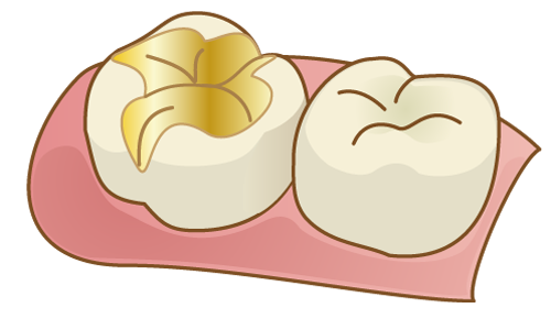 ゴールド