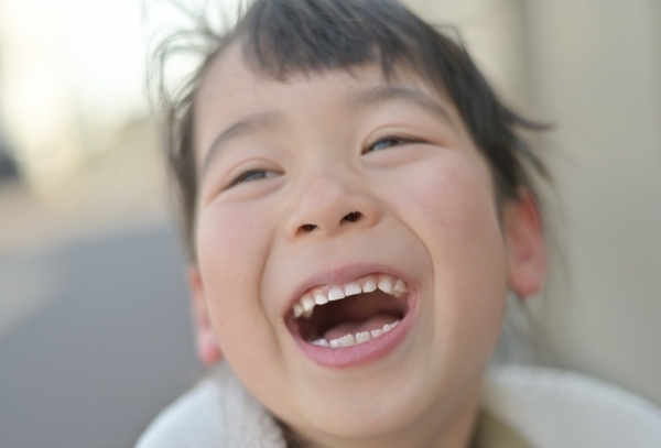 子ども歯の治療_コピー