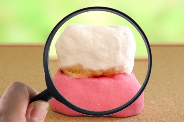 歯茎がやせてきた