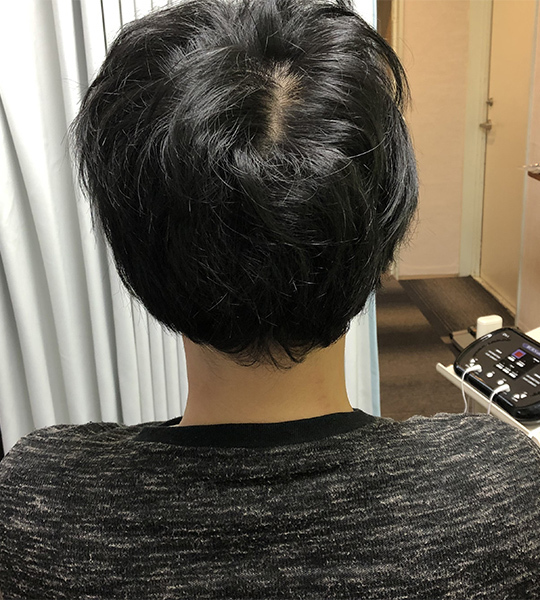 施術メニュー/関節歪み施術After