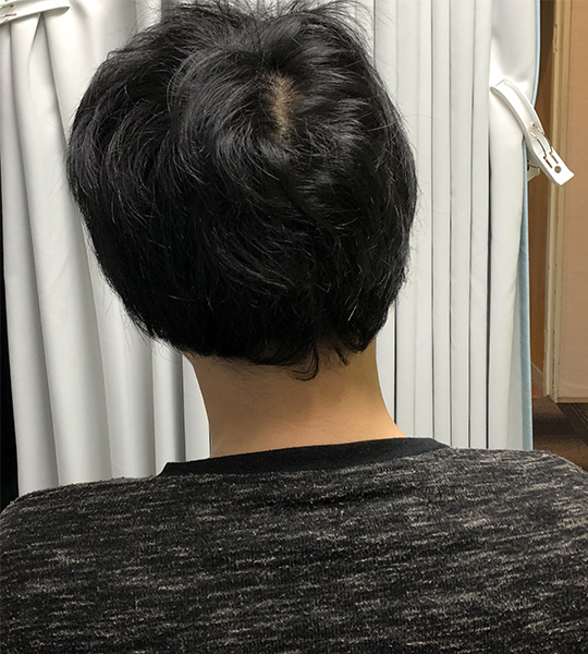 施術メニュー/関節歪み施術Before