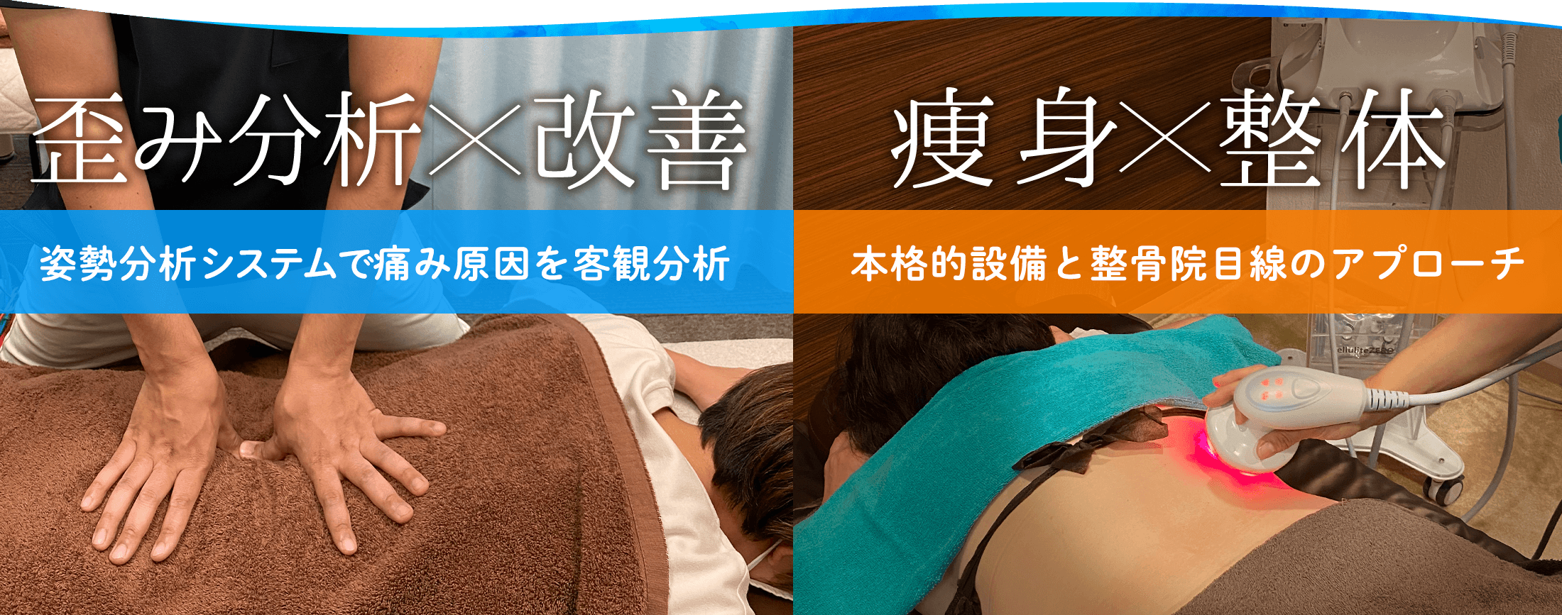 明舞整骨院|姿勢分析システムで姿勢・筋肉バランスを解析