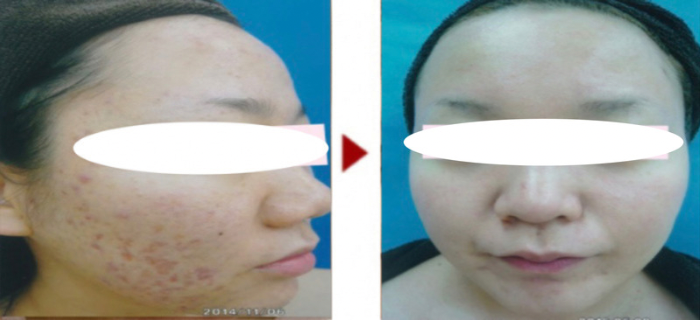 9D12B892-A9A6-4E05-B2A6-3FFCAC4E3353