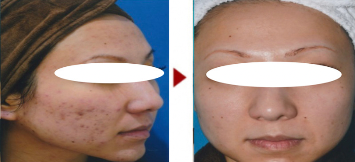 5B34F142-8DC5-4CD5-A885-65BF96F04B54