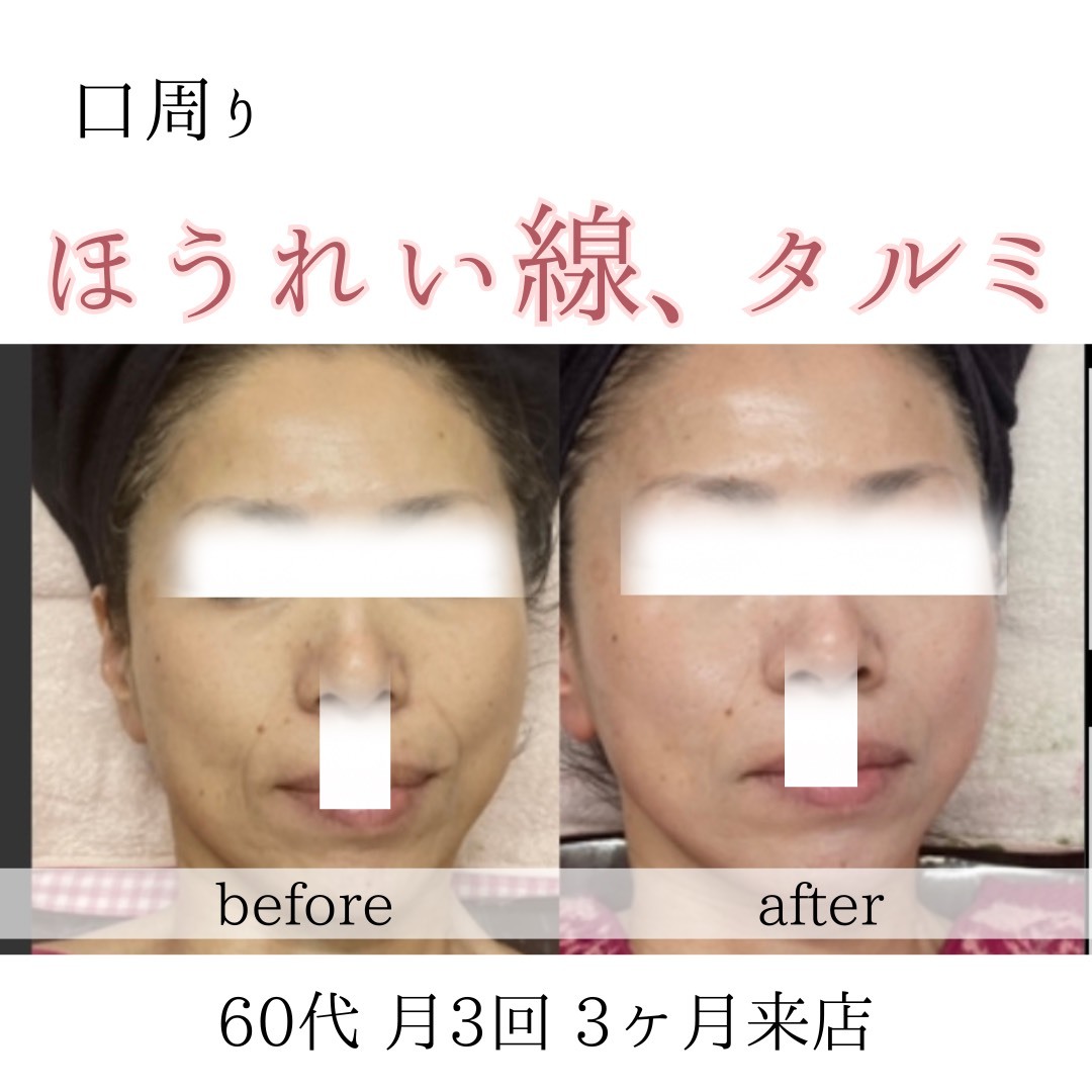 ビフォーアフターのテンプレパターンのコピー.zip - 1