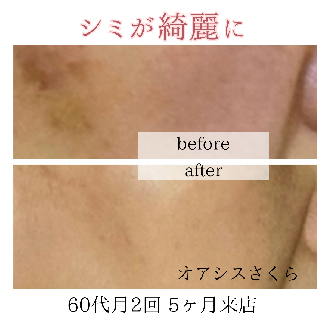 ビフォーアフターのテンプレパターンのコピー (3)