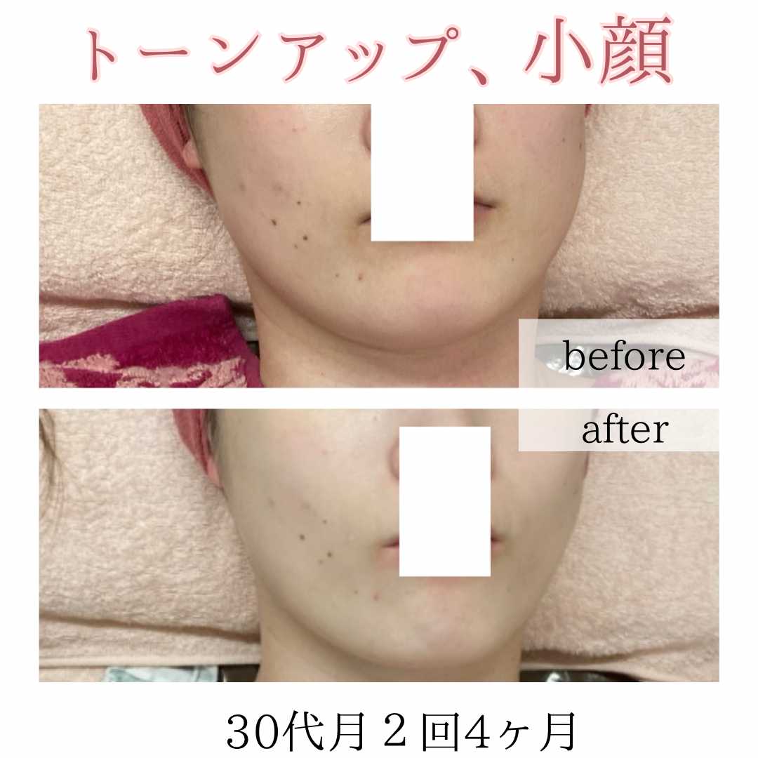 ビフォーアフターのテンプレパターンのコピー (7)