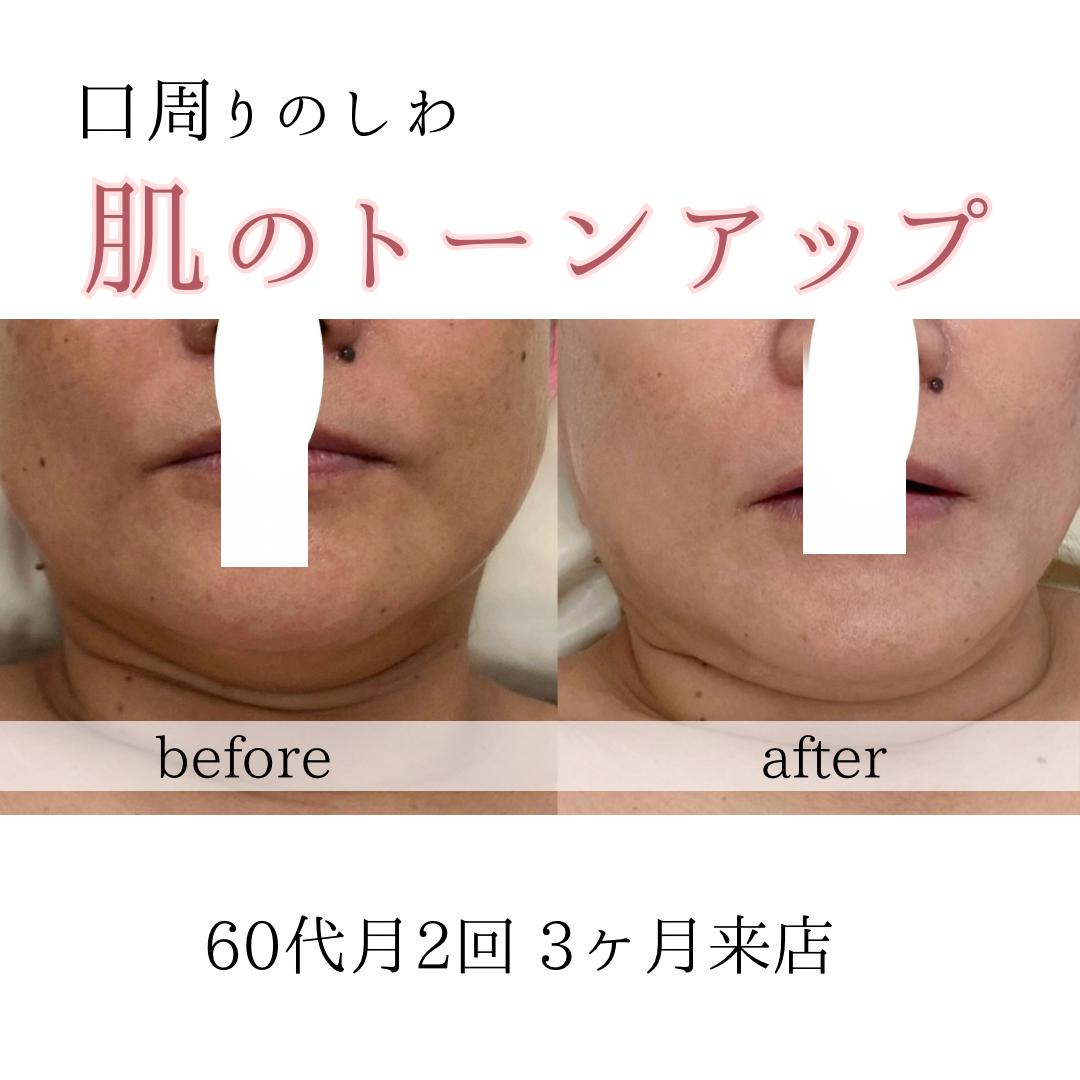 ビフォーアフターのテンプレパターンのコピー (4)