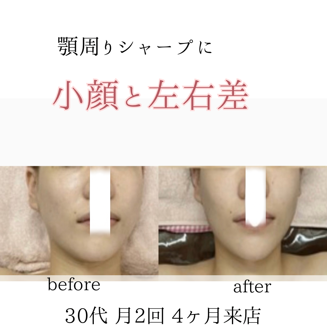 ビフォーアフターのテンプレパターンのコピー