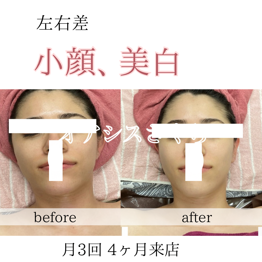 ビフォーアフターのテンプレパターンのコピー (11)