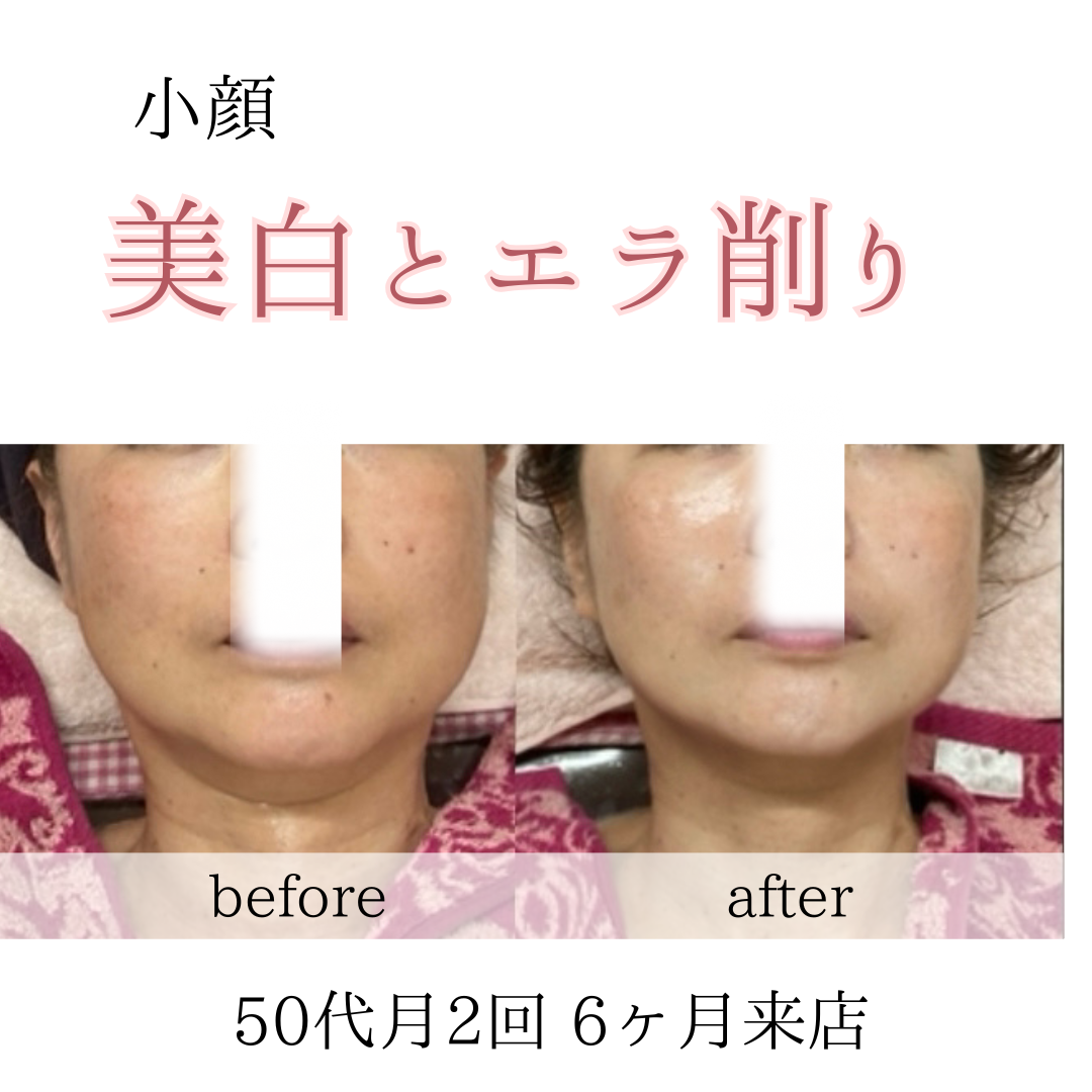 ビフォーアフターのテンプレパターンのコピー.png (2)