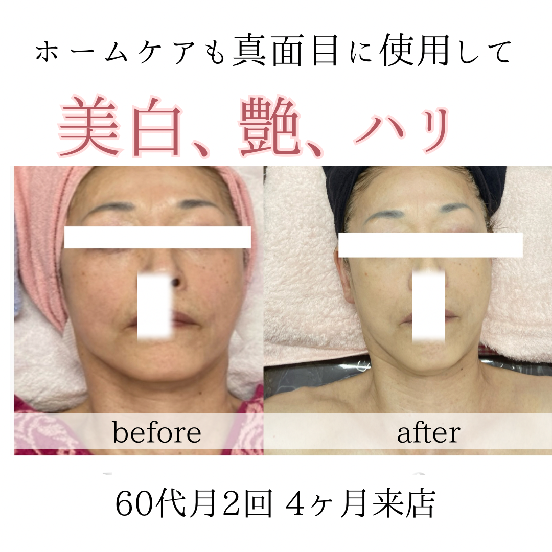 ビフォーアフターのテンプレパターンのコピー (10)