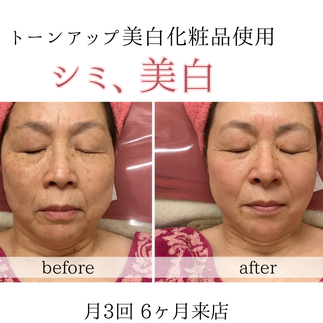 ビフォーアフターのテンプレパターンのコピー.zip - 1 (1)