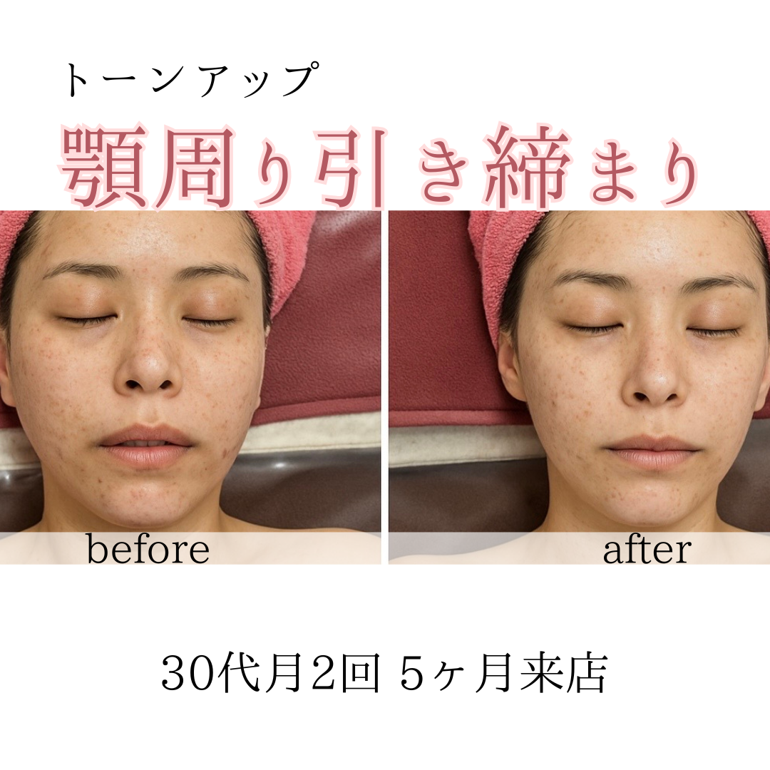 ビフォーアフターのテンプレパターンのコピー.png (1)