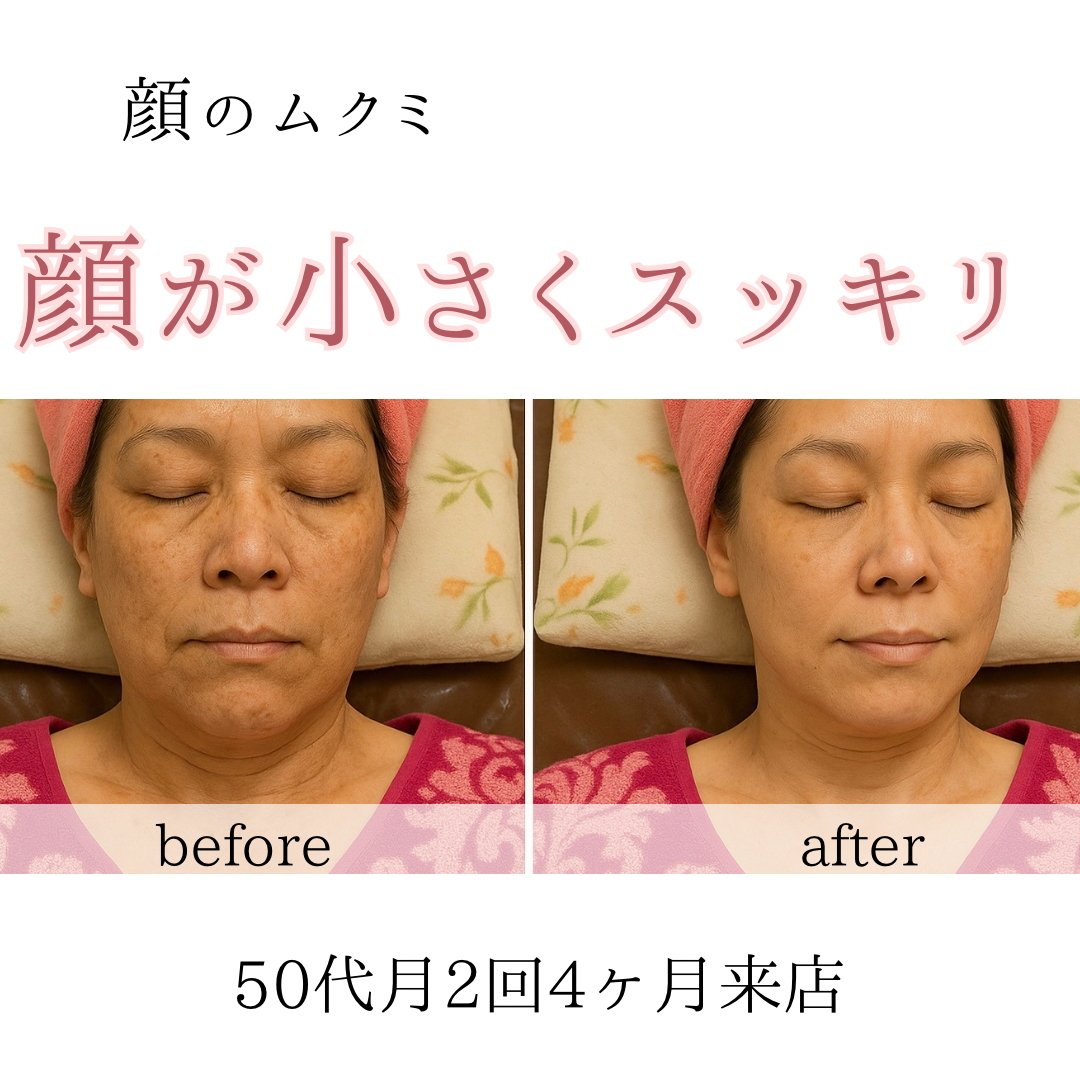 ビフォーアフターのテンプレパターンのコピー (9)