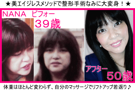 ビフォーアフター