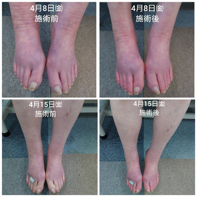 Polish_20220415_181101044