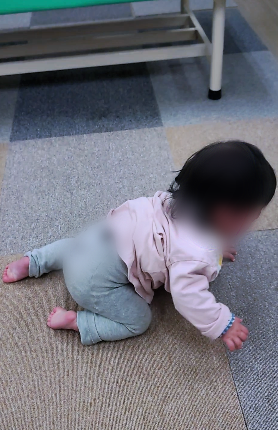 股関節症7か月女児