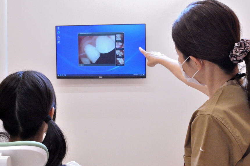 口腔内カメラ2