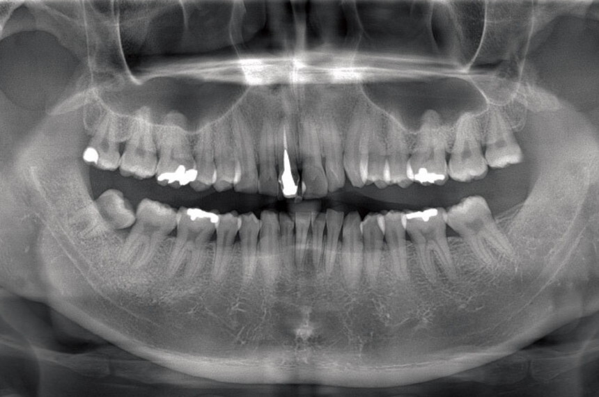 xray