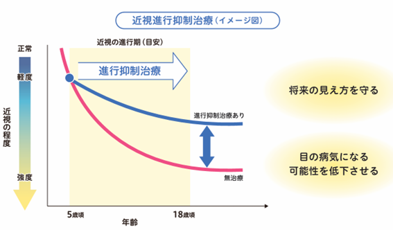 近視の進行を抑える治療の目的