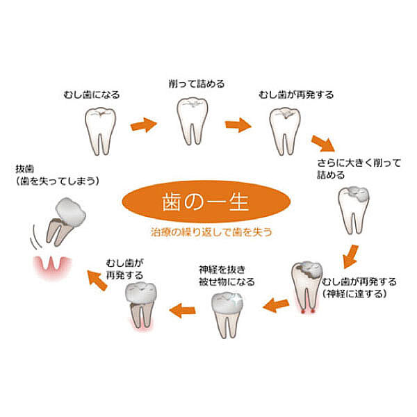 サイクル(治療)
