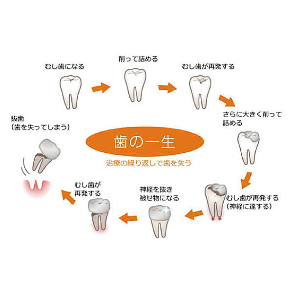 サイクル（治療）