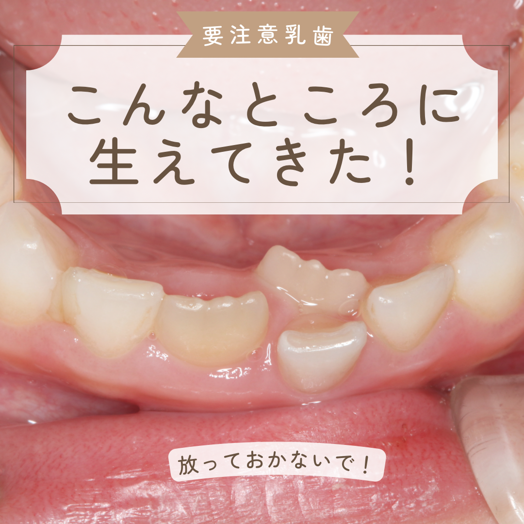 48645B81-CAFB-4176-99DD-C3335B3CFB05