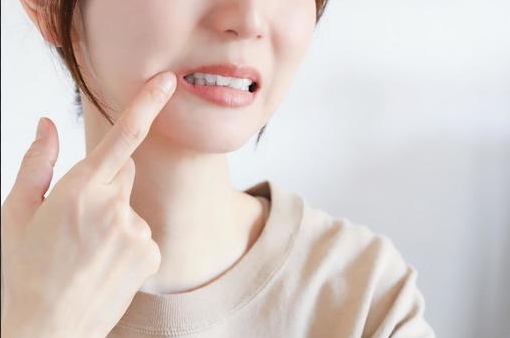虫歯