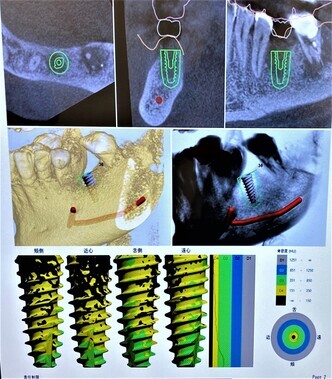 07_コピー_コピー