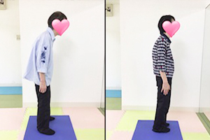 画像を使い施術前と施術後の変化