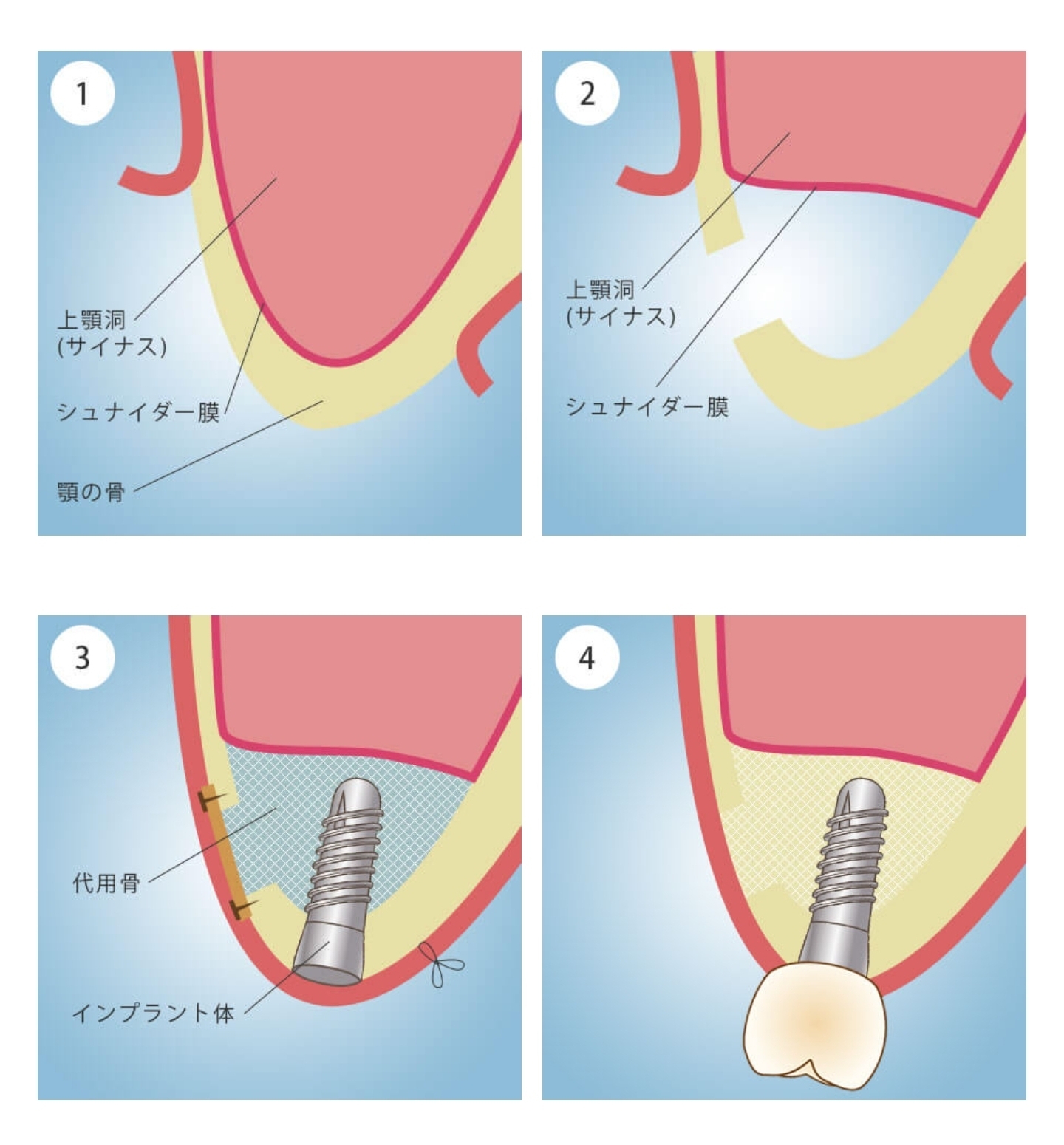 Screenshot_20221116_130843