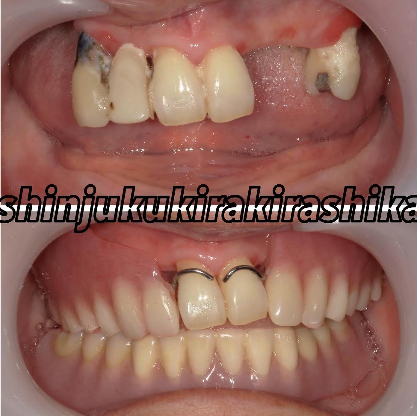 Screenshot_20221128_181853