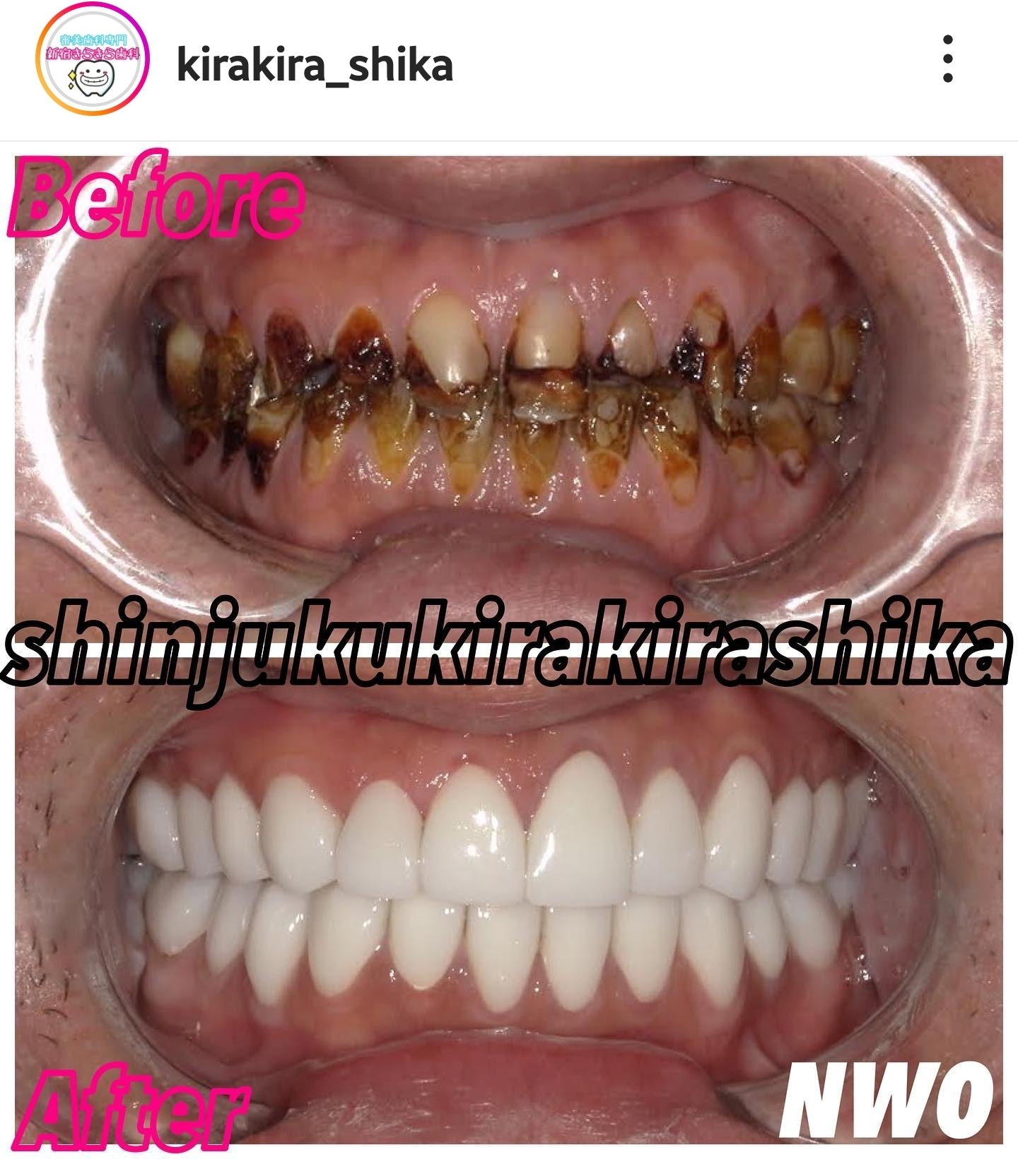 Screenshot_20230523_111211_Instagram