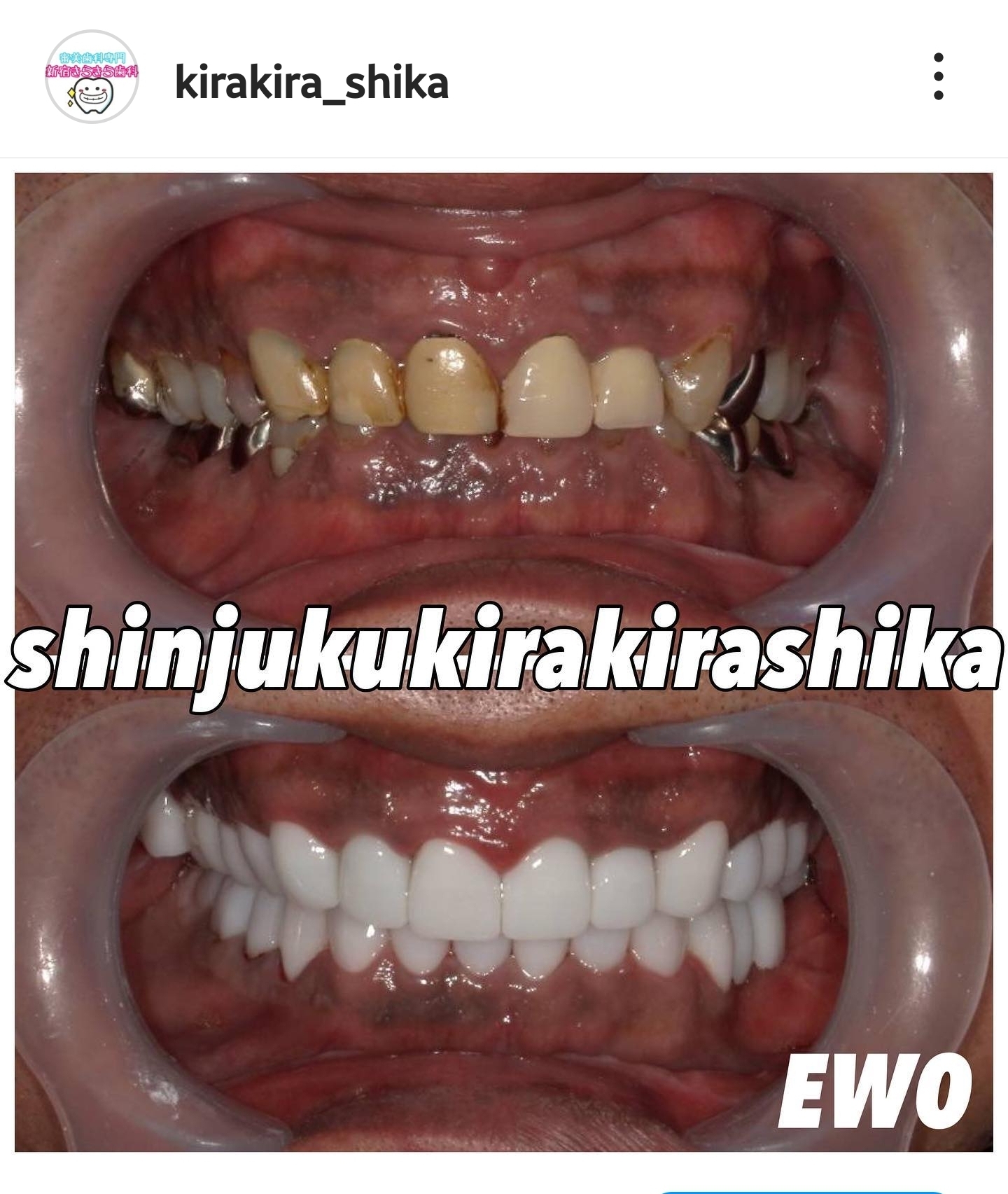 Screenshot_20230523_113312_Instagram