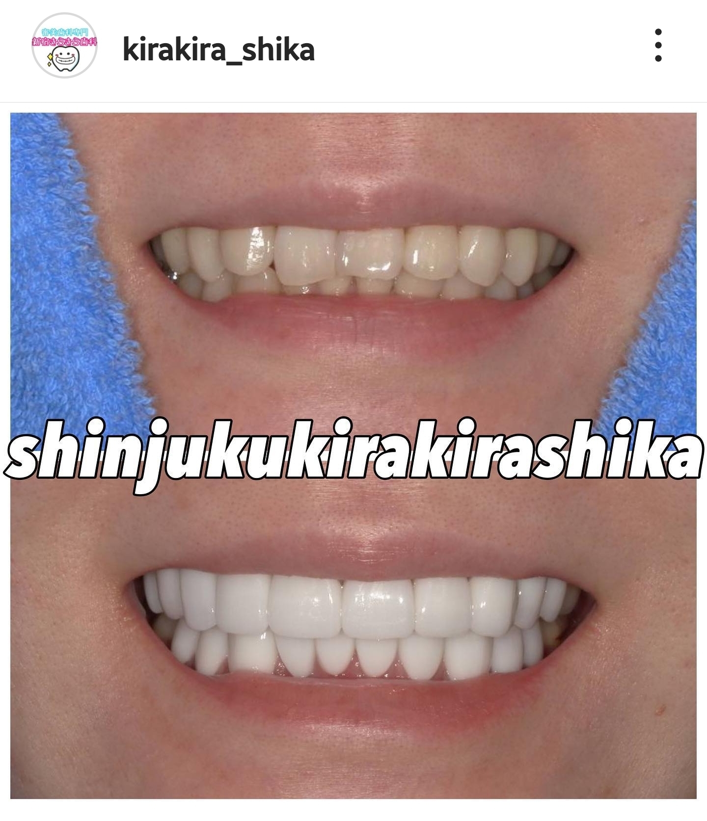 Screenshot_20230523_113518_Instagram