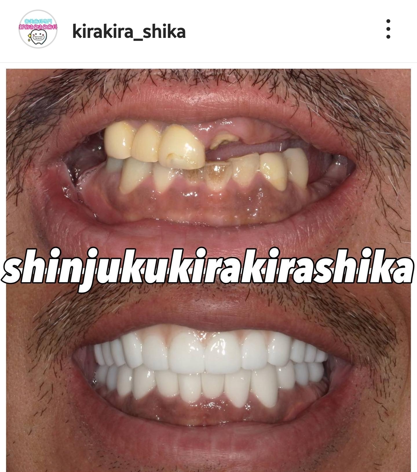 Screenshot_20230523_113938_Instagram