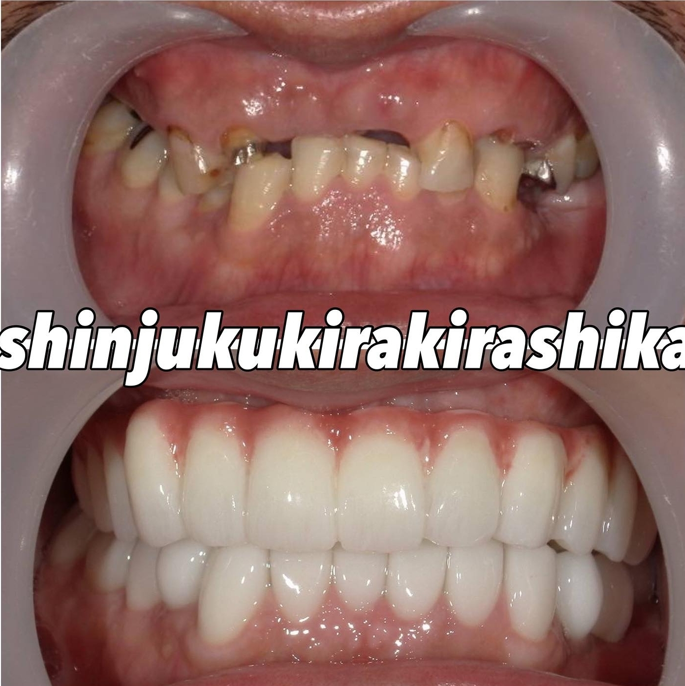 Screenshot_20230721_114850_Instagram