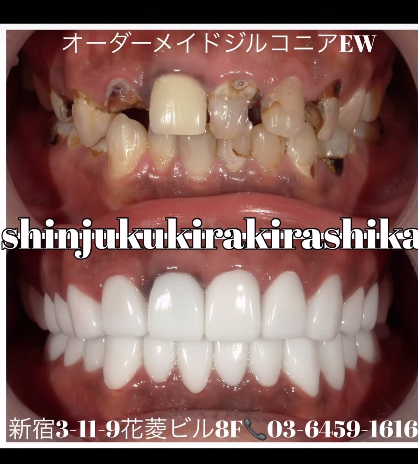 Screenshot_20250317_140926_Instagram