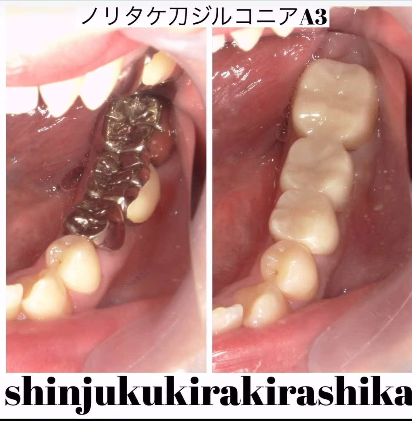 Screenshot_20250317_141415_Instagram