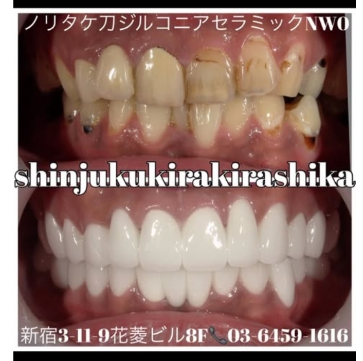 Screenshot_20250317_141640_Instagram