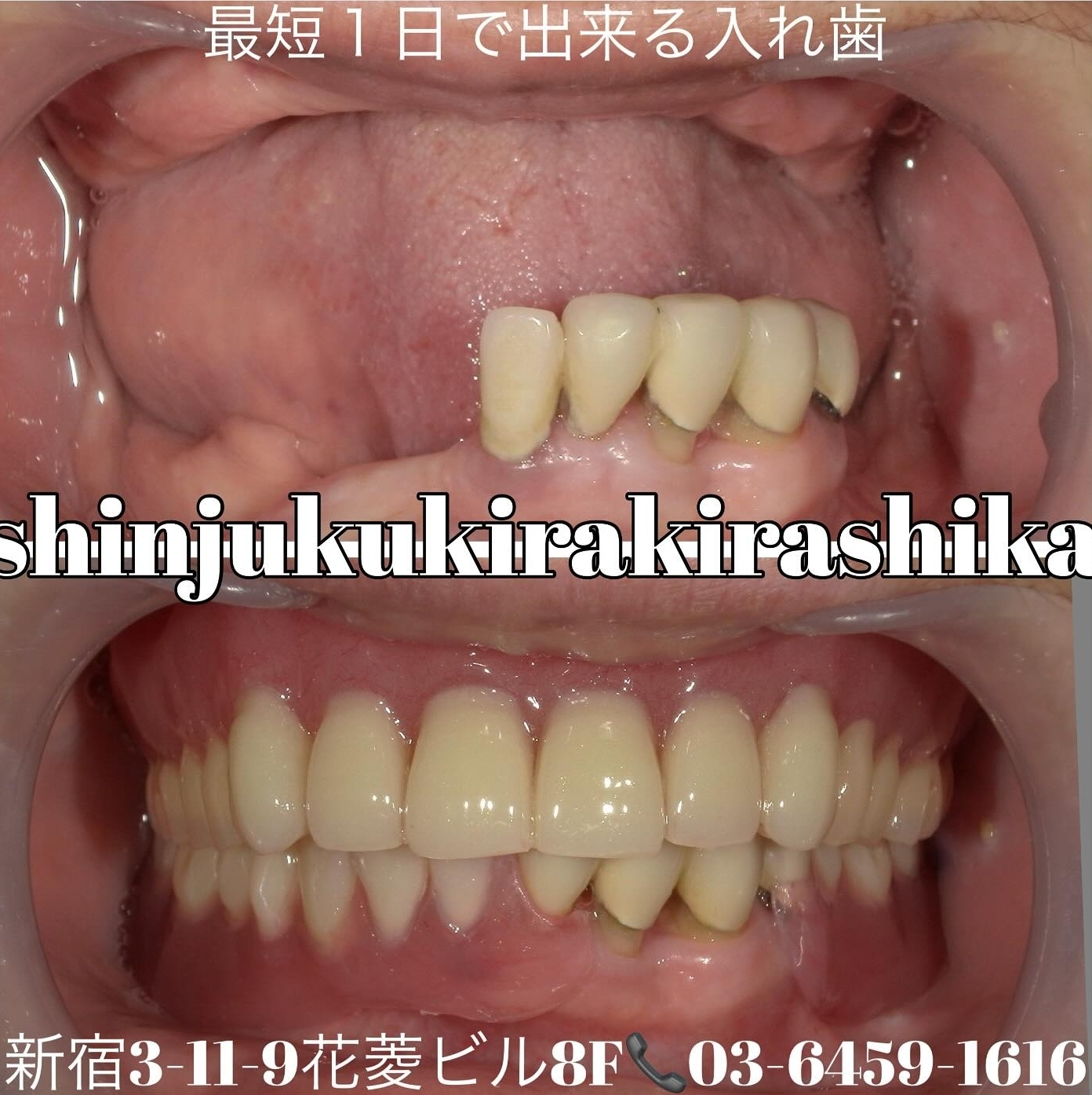 Screenshot_20250326_094622_Instagram