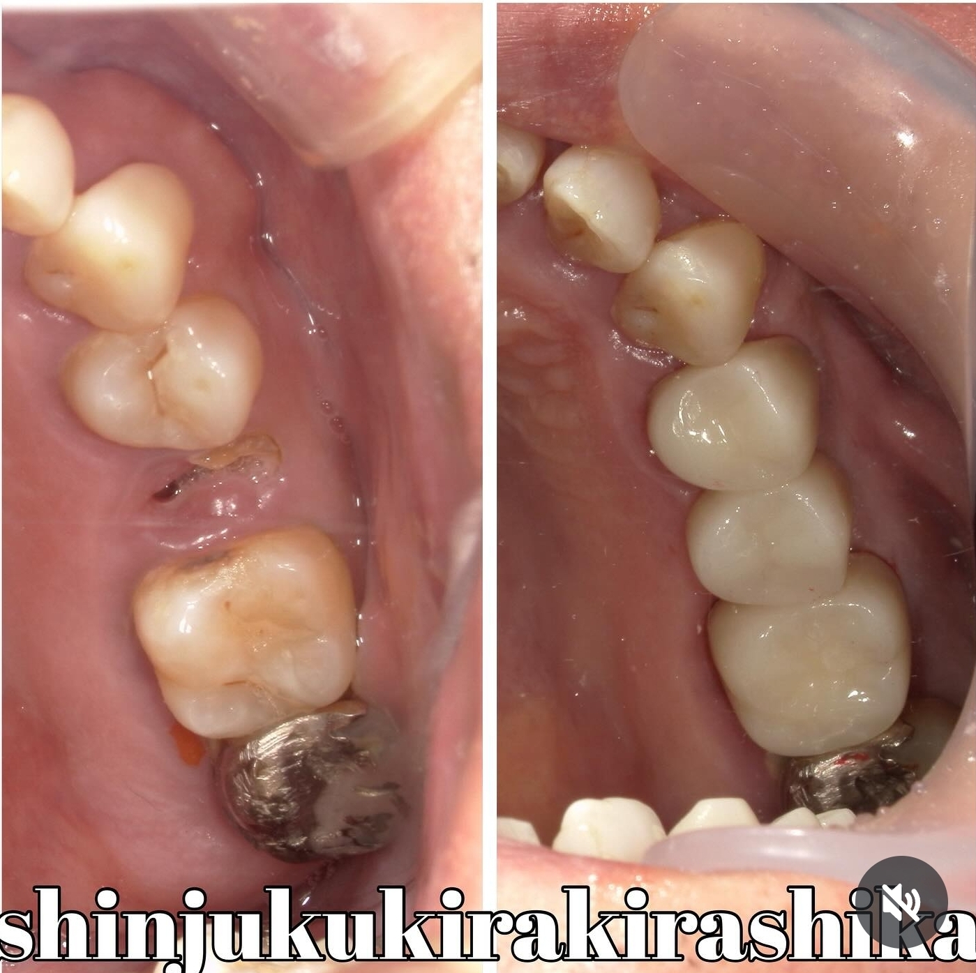 Screenshot_20250507_101405_Instagram