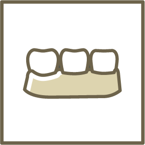 ノンクラスプデンチャー