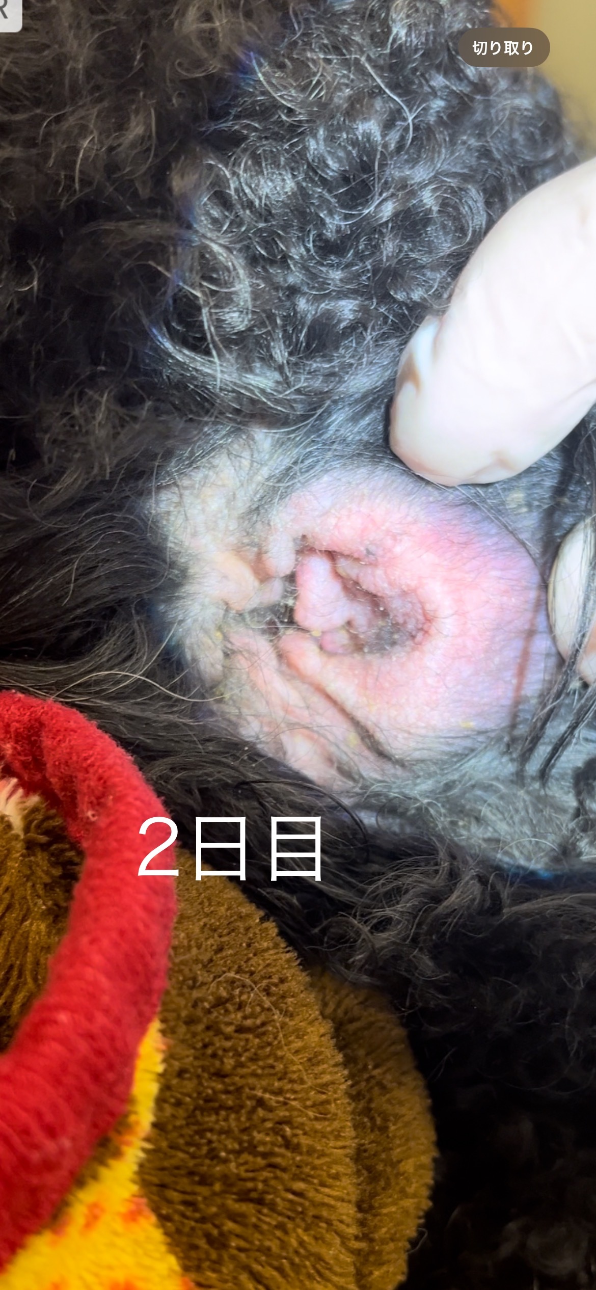 治療2日目