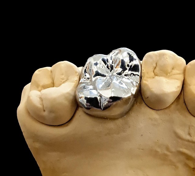 チタンクラウン