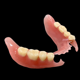 ノンクラスプデンチャー